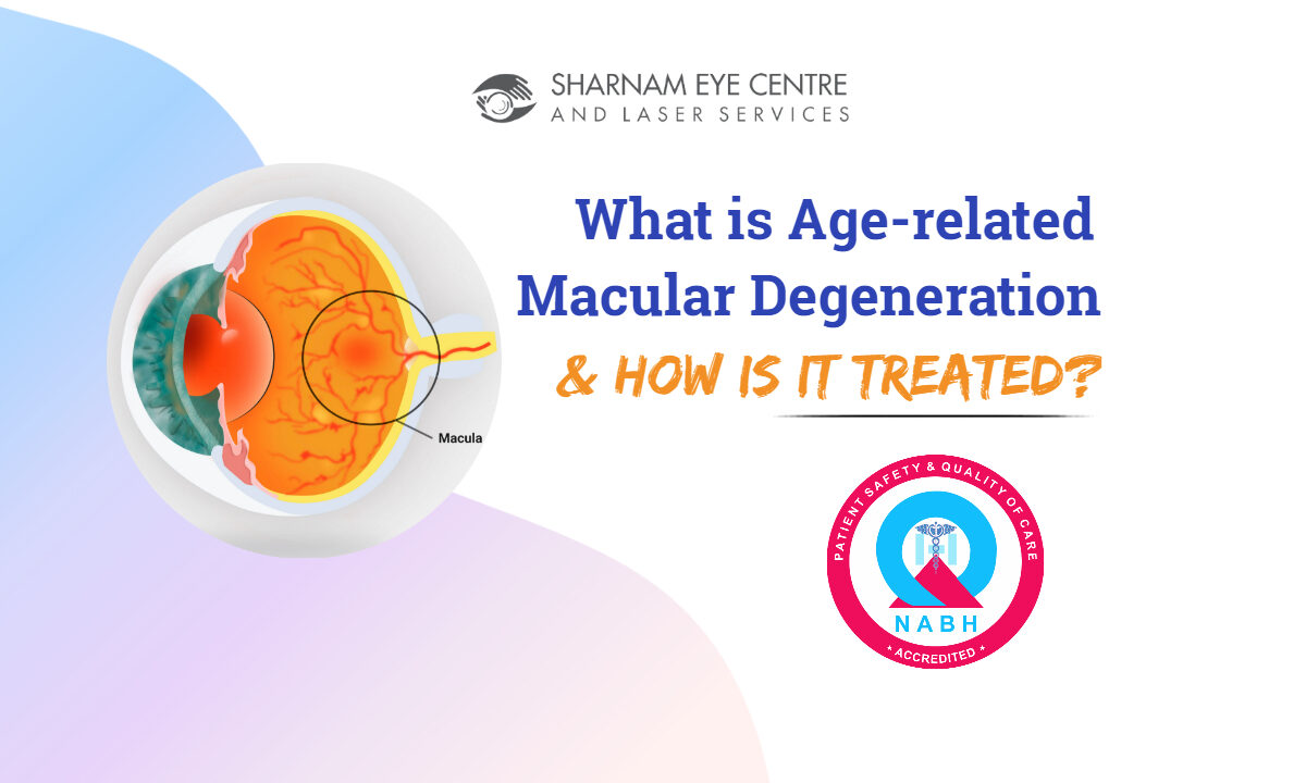 what is Age-Related Macular Degeneration