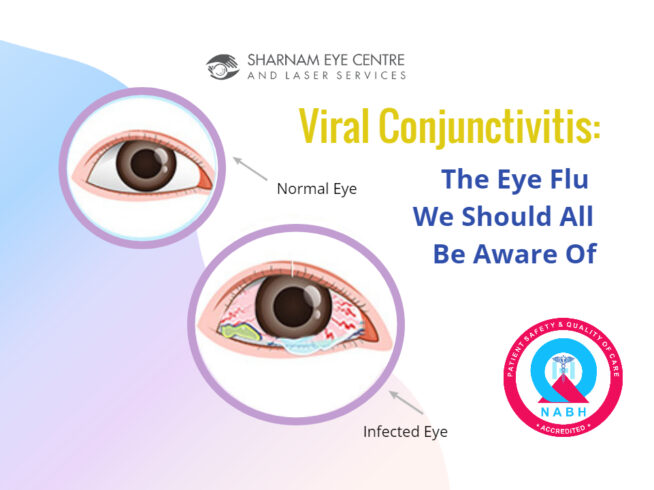 Viral Conjunctivitis treatment in Gahziabad