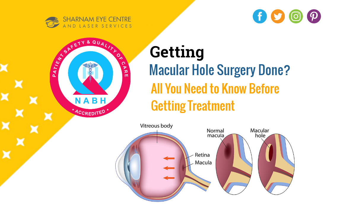 Getting Macular Hole Surgery Done