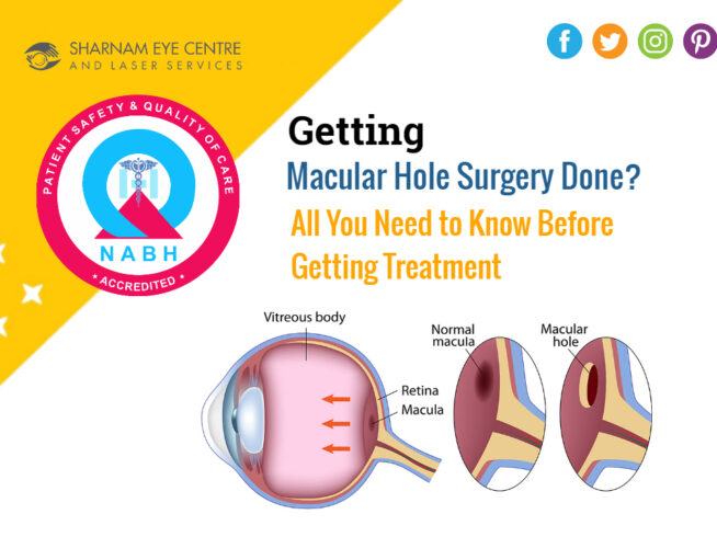 Getting Macular Hole Surgery Done