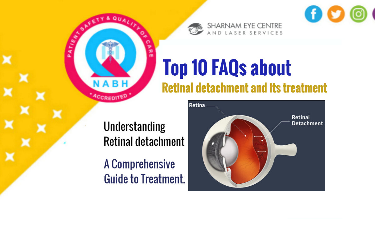 FAQs about Retinal Detachment