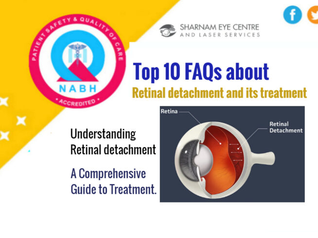 FAQs about Retinal Detachment